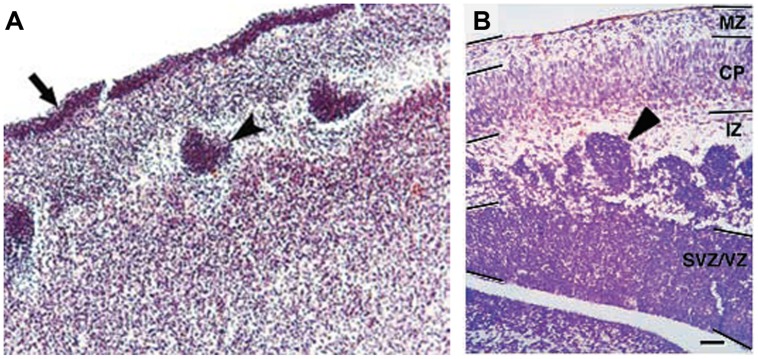 FIGURE 4