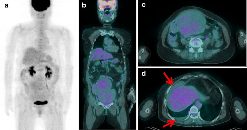 Fig. 2