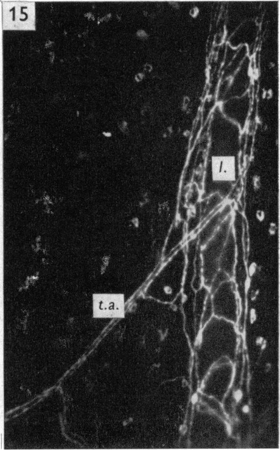 Fig. 15