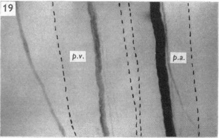 Fig. 19