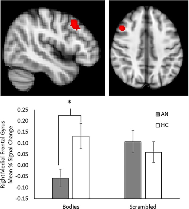 Fig 5