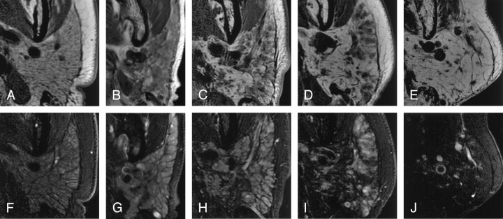 Fig 3.