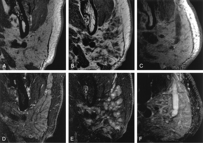 Fig 2.