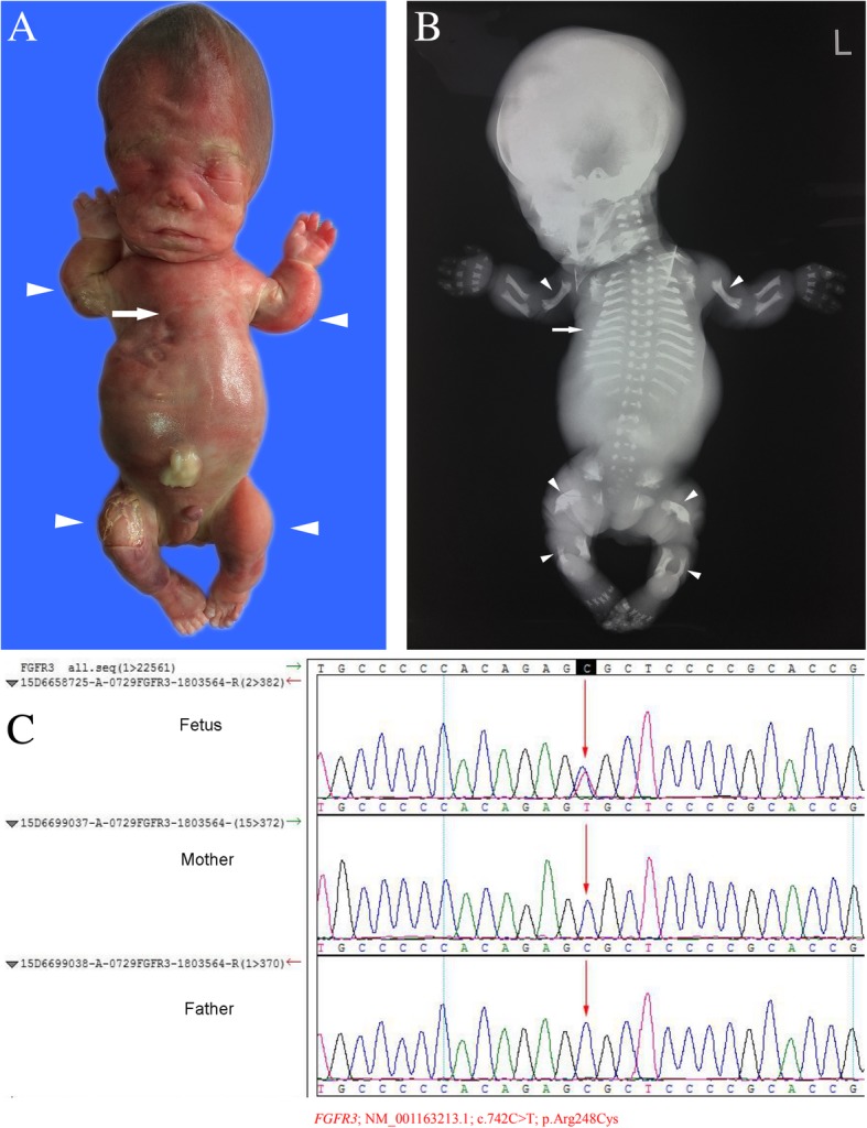 Fig. 4