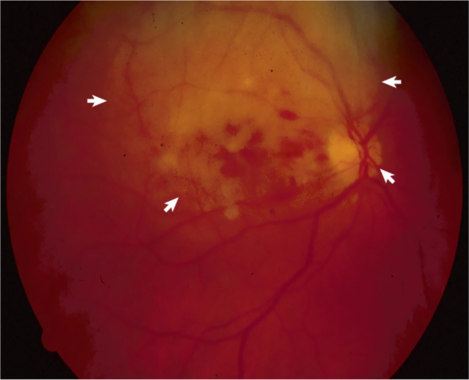 Figure 4: