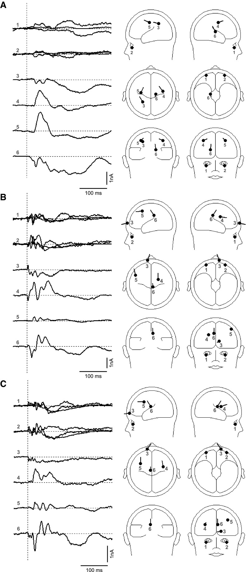 Fig. 10