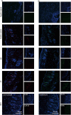 Fig. 11