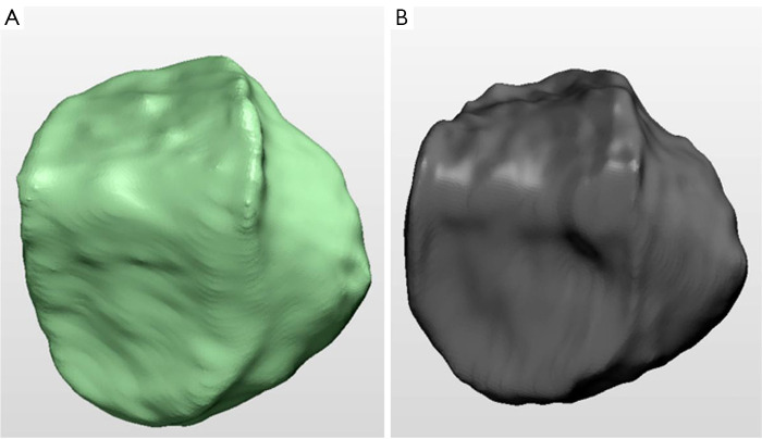 Figure 14