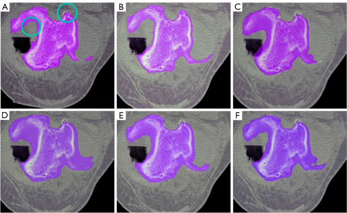 Figure 25