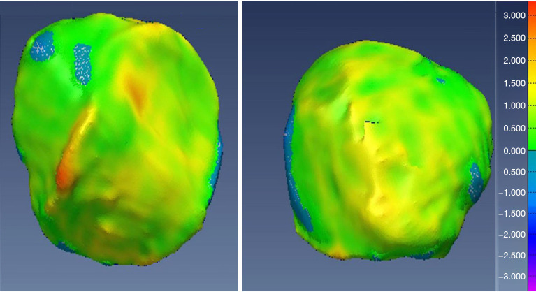 Figure 22