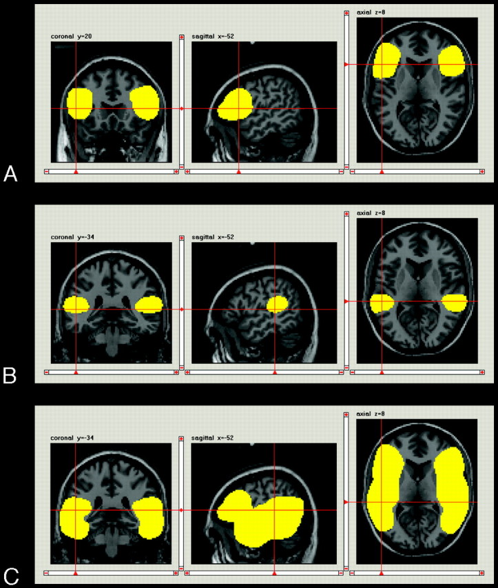 Fig 2.