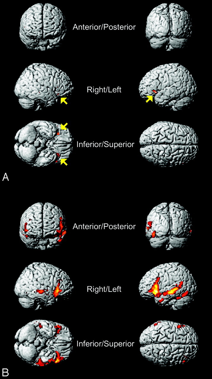 Fig 4.