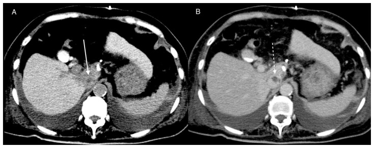 Figure 16