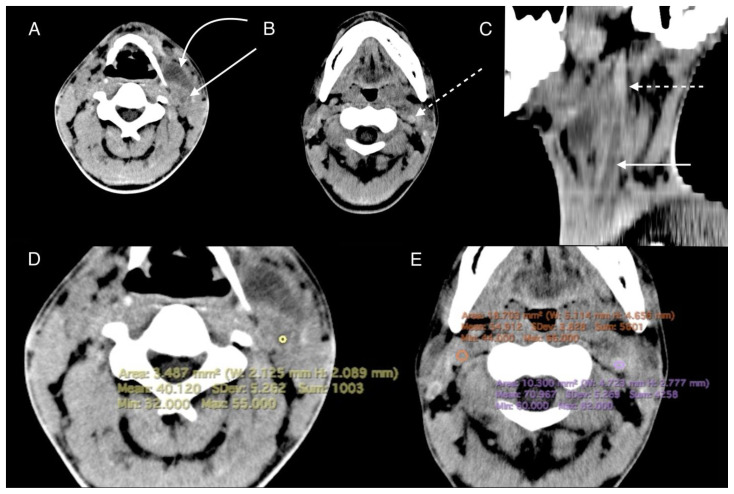 Figure 13