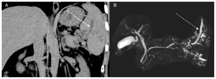 Figure 19