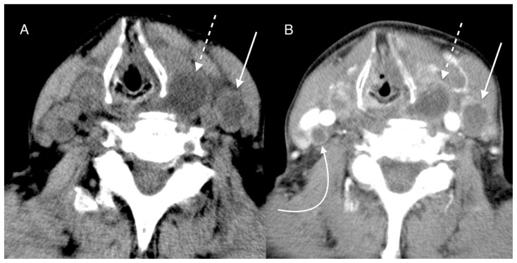 Figure 18