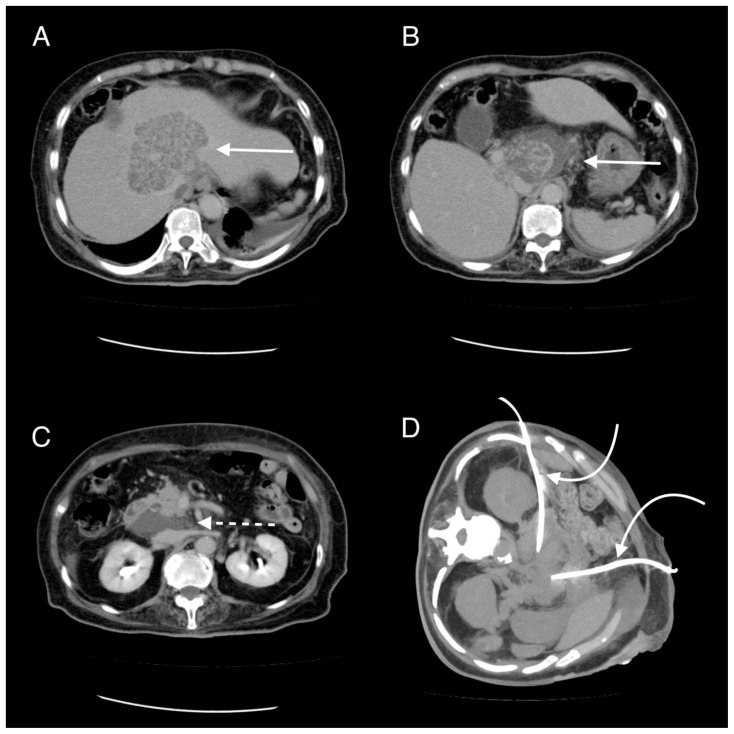 Figure 15