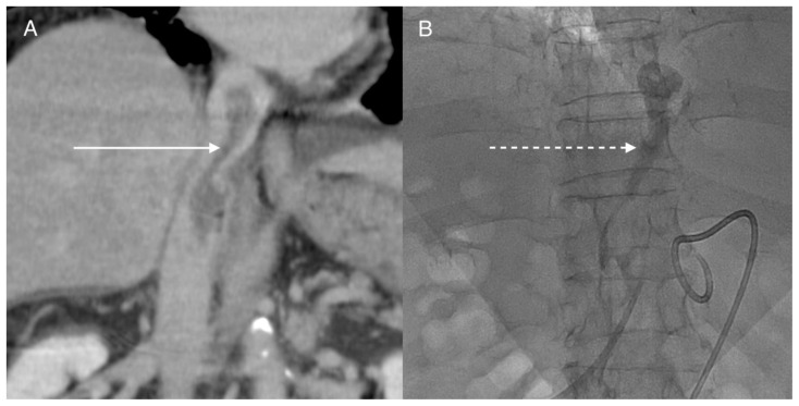 Figure 17