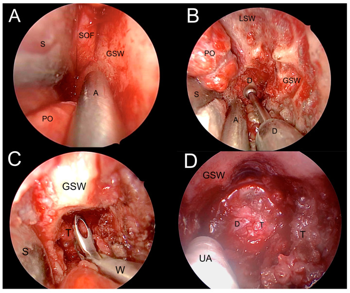 Figure 10