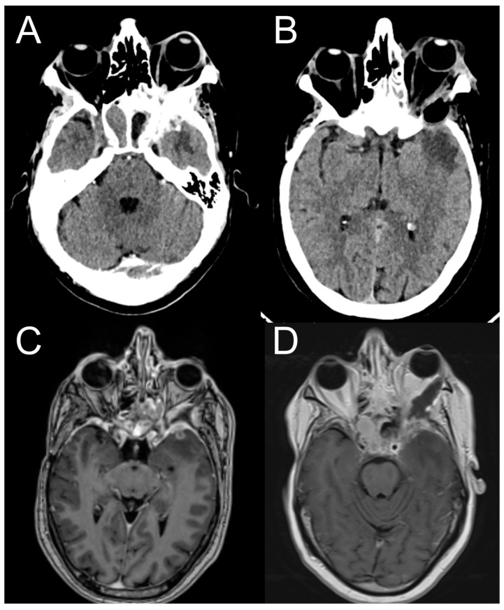 Figure 11