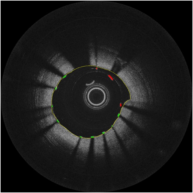 Fig 5