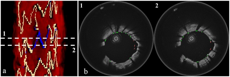 Fig 9