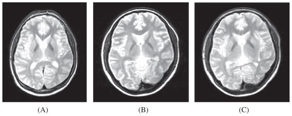 Fig. 10