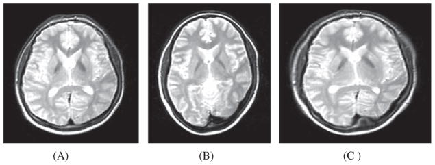 Fig. 12