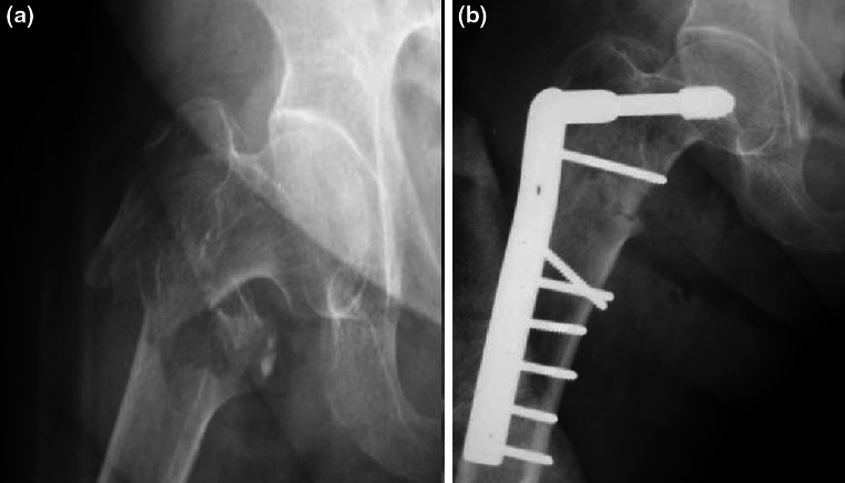 Fig. 2