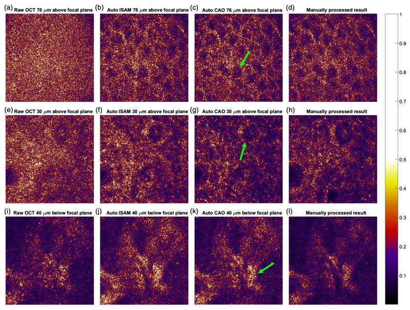 Fig. 6