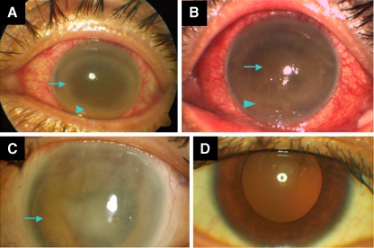 Fig. 1