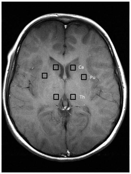 Fig. 1