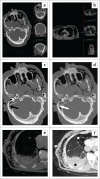 FIGURE 6