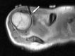 Figure 2b: