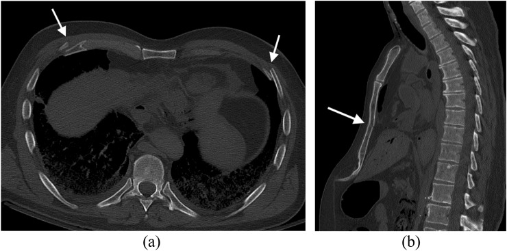 Figure 15.