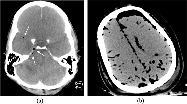 Figure 6.