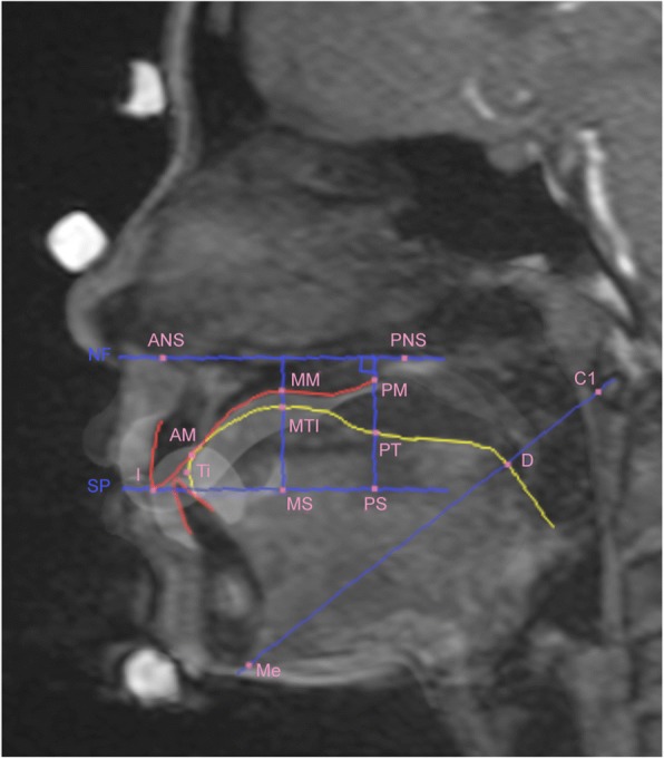 Fig. 5