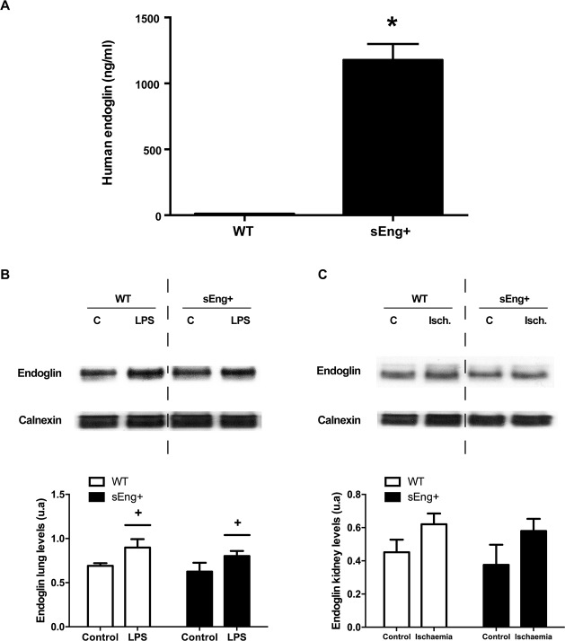 Circulating soluble endoglin modifies the inflammatory response in mice ...