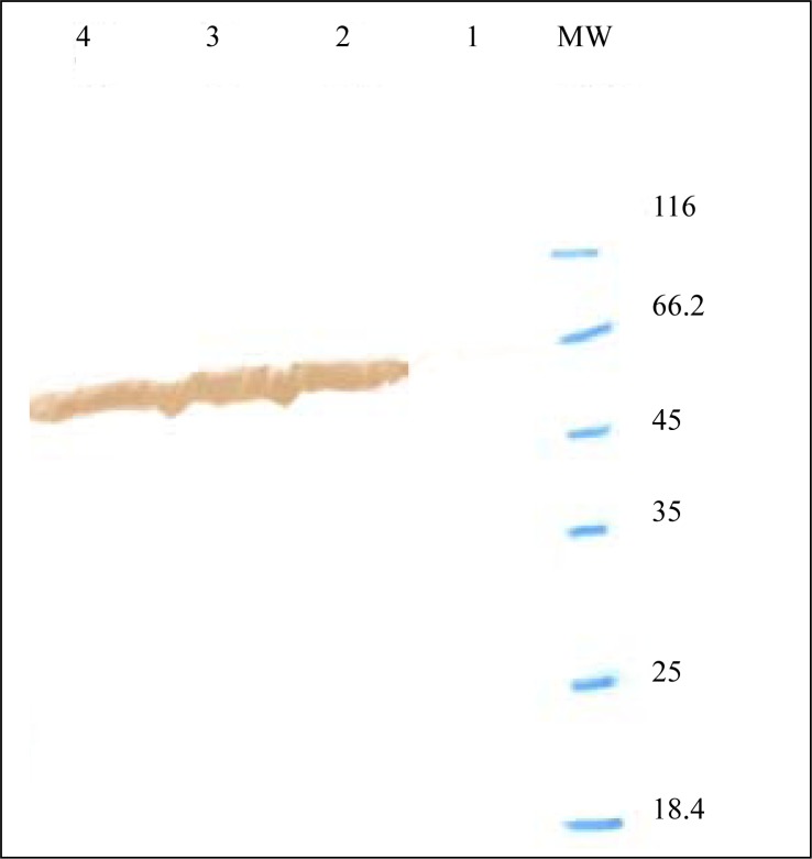 Fig. 11