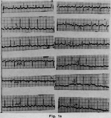 Fig. 1a