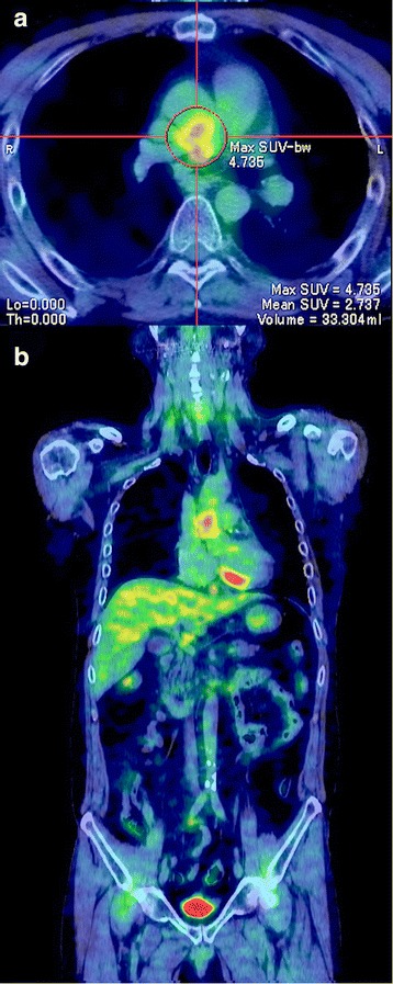 Fig. 3