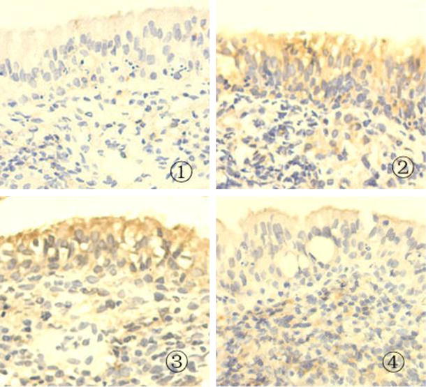 Fig. 2