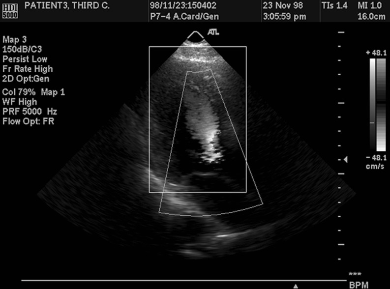 Fig. 4