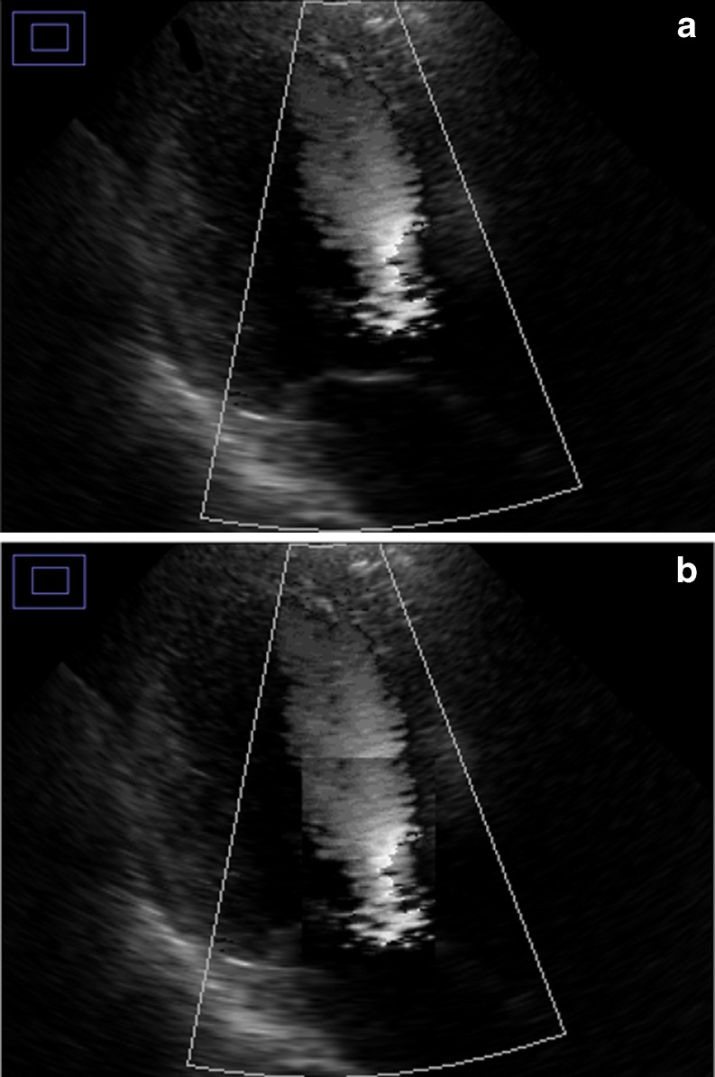 Fig. 6