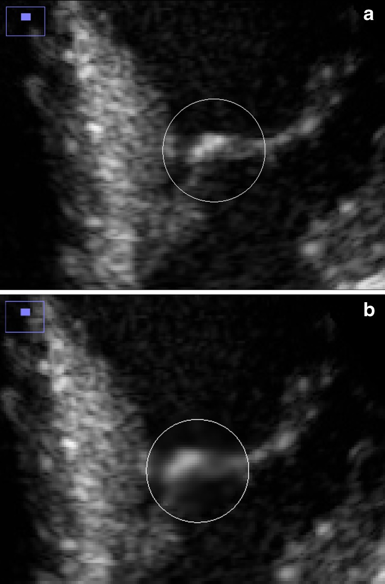 Fig. 9