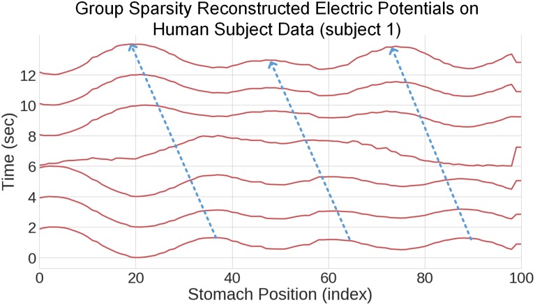 Fig 10