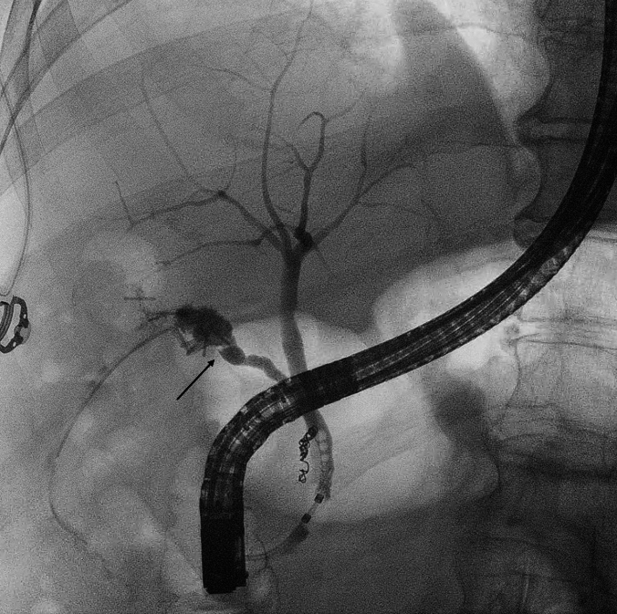 Fig. 1