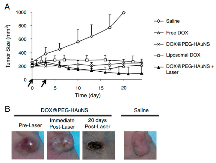 Figure 11