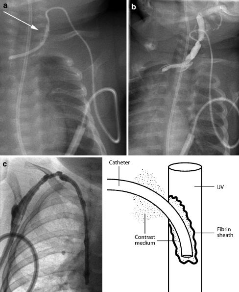 Fig. 21