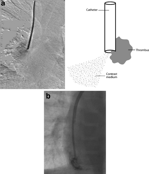 Fig. 24